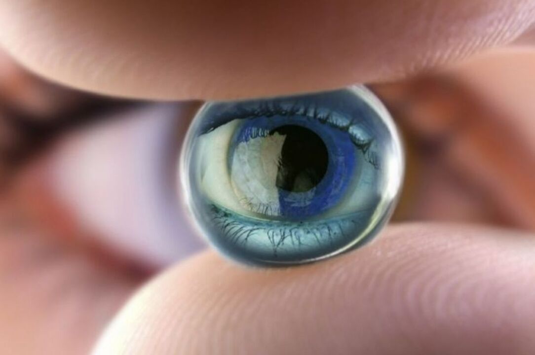 Basics Contact lenses